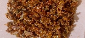 hyperpigmentation6767