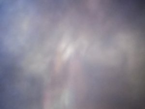 Vitreous